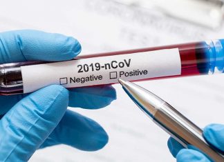 Bollettino epidemiologico del giorno: 28 agosto 2022