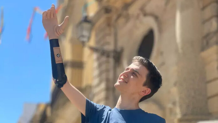 mano bionico